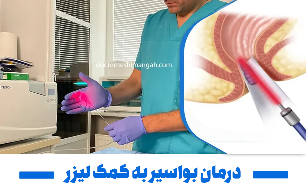 درمان بواسیر به کمک لیزر
