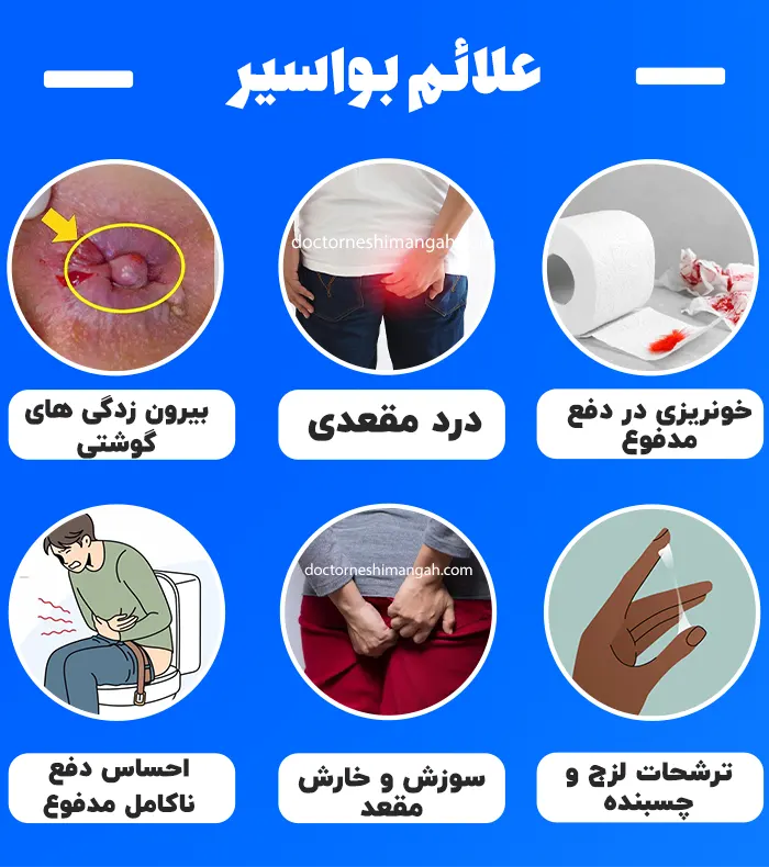 علائم بواسیر