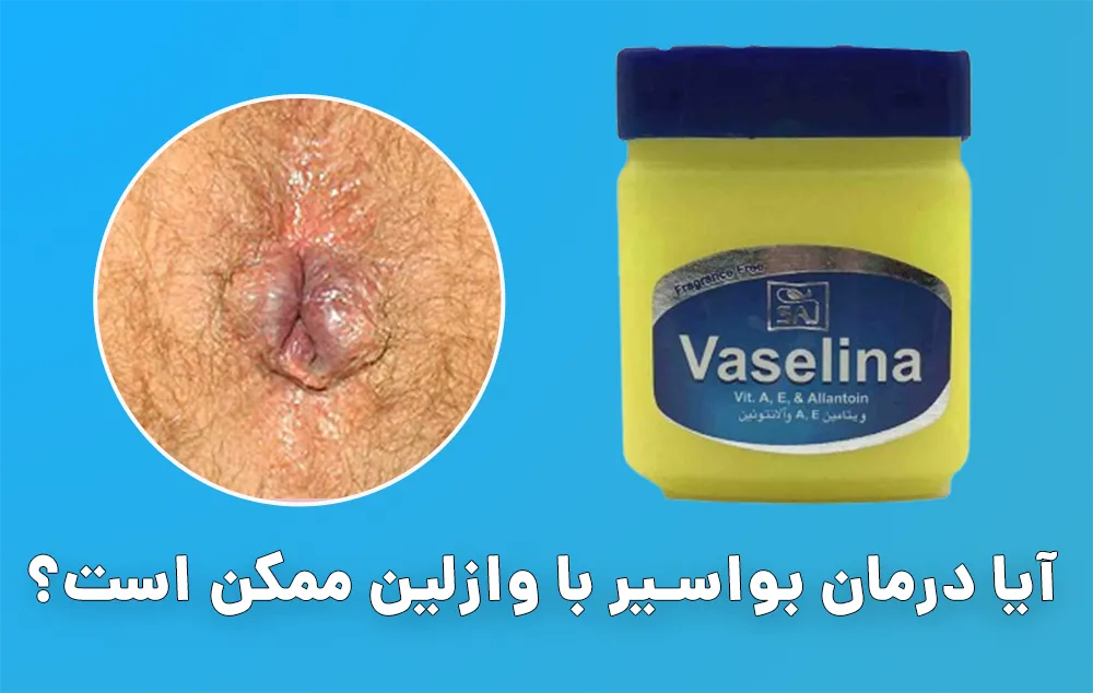 درمان بواسیر با وازلین