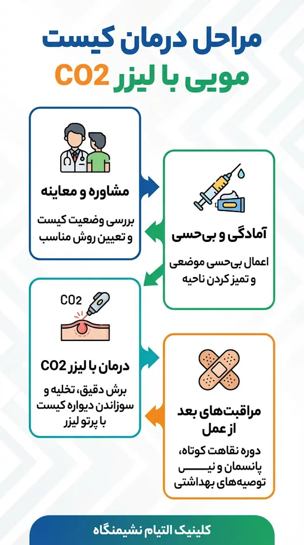 مراحل درمان کیست مویی با لیزر