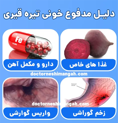دلیل مدفوع خونی تیره