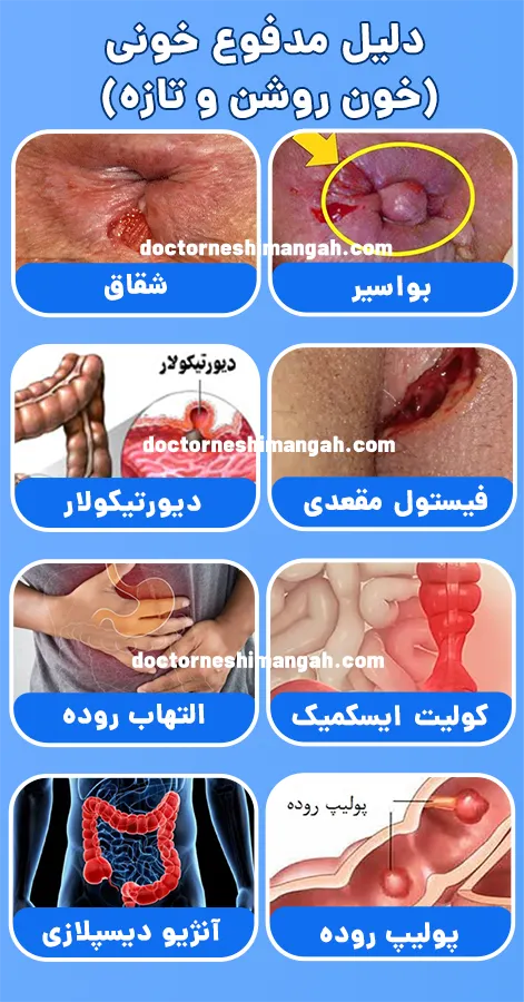 دلیل مدفوع خونی روشن