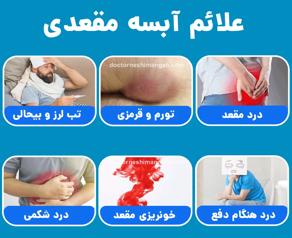 آبسه مقعدی چیست؟ علائم آبسه، خطرات، نحوه درمان، پیشگیری به همراه عکس