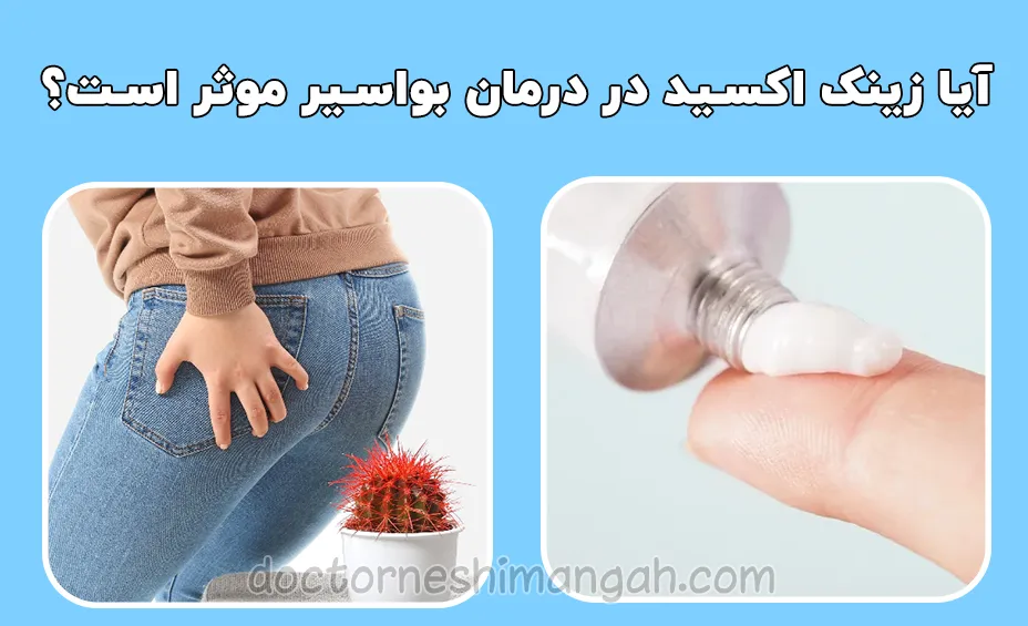 آیا زینک اکسید در درمان بواسیر موثر است؟