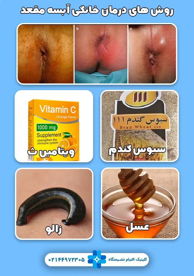 روش های درمان خانگی آبسه مقعد