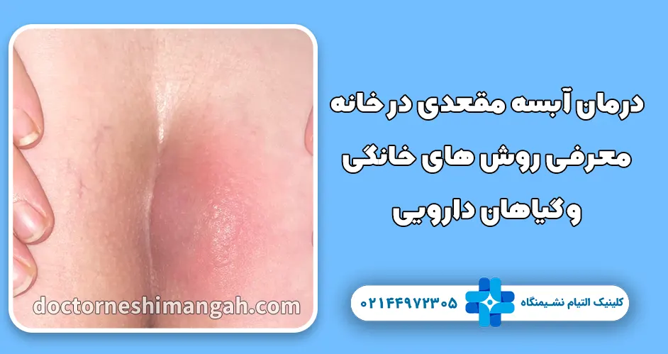 درمان آبسه مقعدی