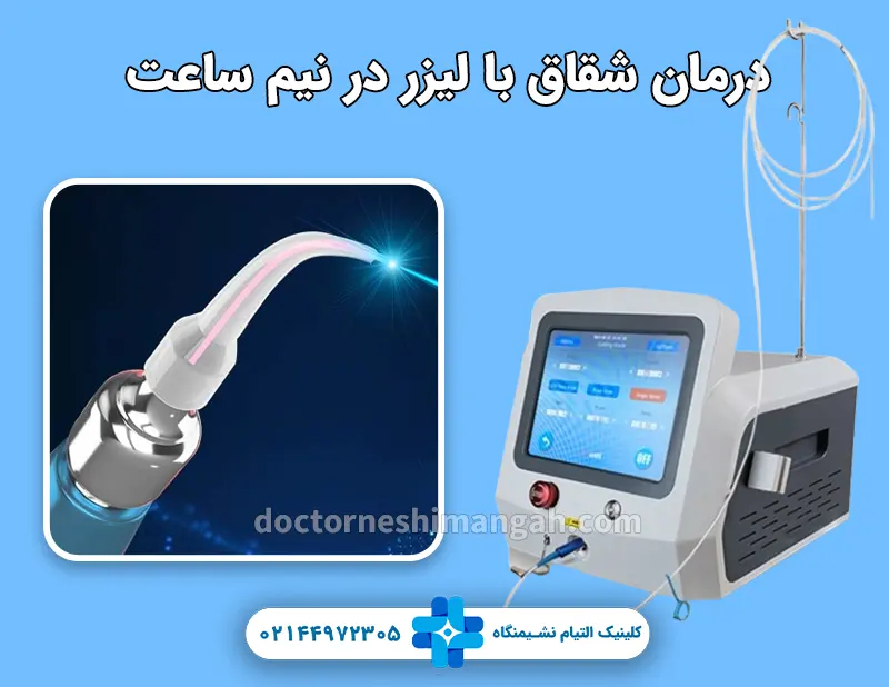 درمان شقاق با لیزر در نیم ساعت