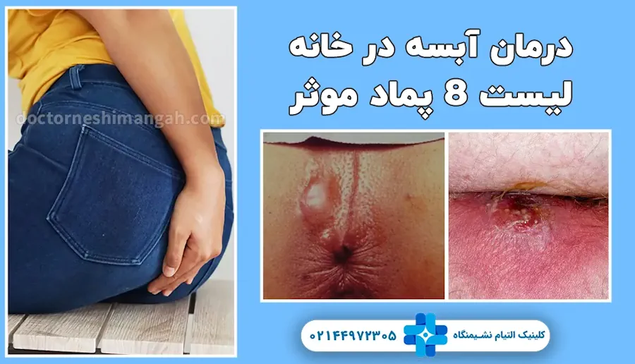 لیست 8 پماد برای درمان آبسه مقعدی