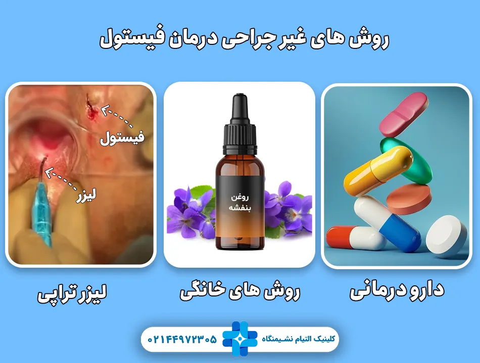 روش های غیر جراحی درمان فیستول