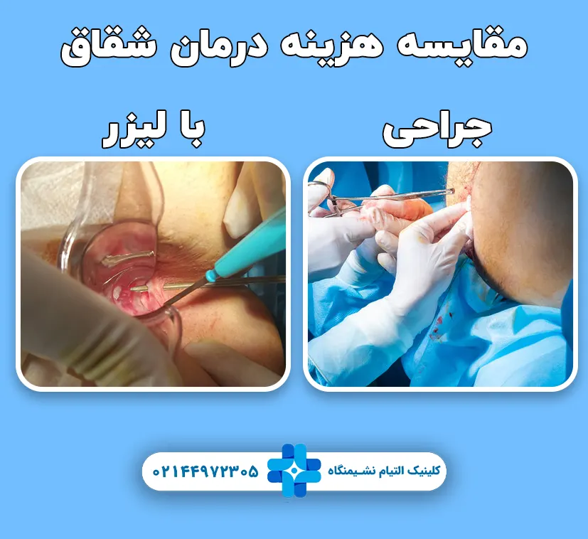 مقایسه هزینه درمان شقاق با لیزر و روش های جراحی