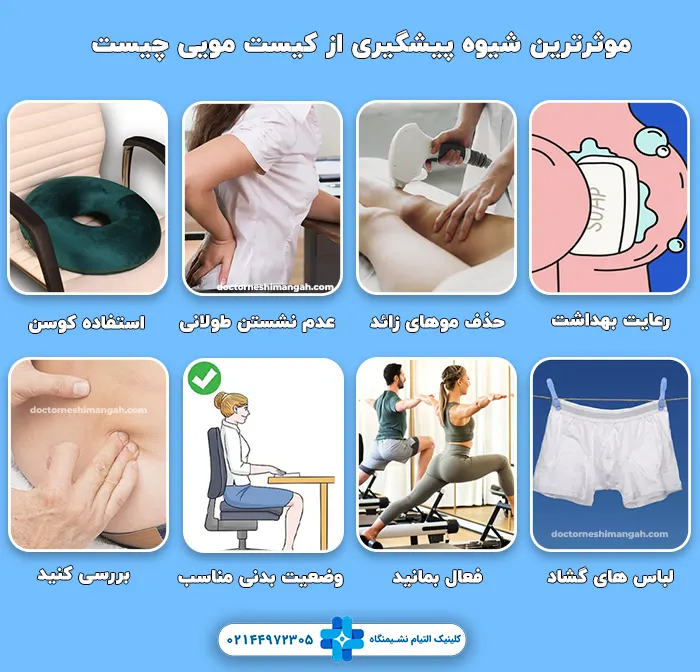 پیشگیری از کیست مویی