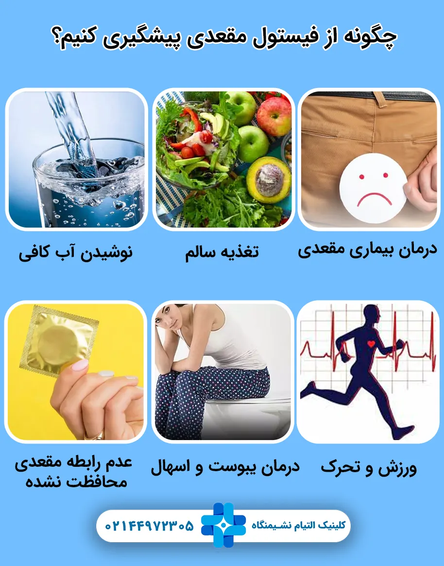 چگونه از فیستول مقعدی پیشگیری کنیم