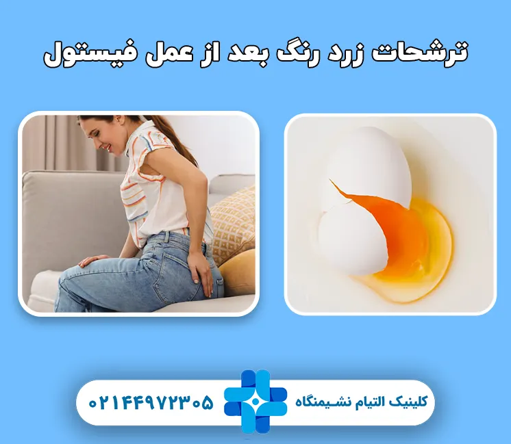 ترشحات زرد رنگ بعد از عمل فیستول