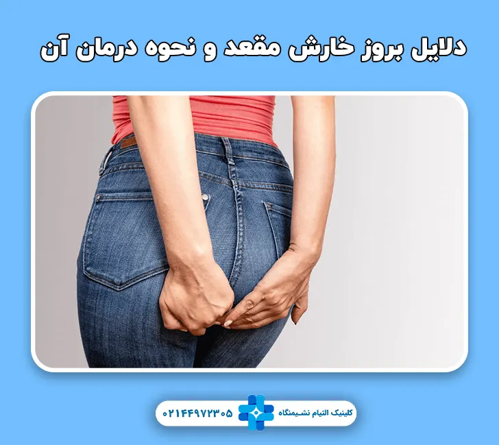دلایل اصلی خارش مقعد و سریعترین روش درمان آن