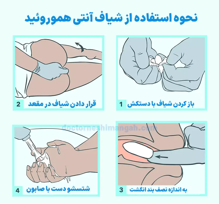 دستورالعمل مصرف شیاف برای درمان بواسیر