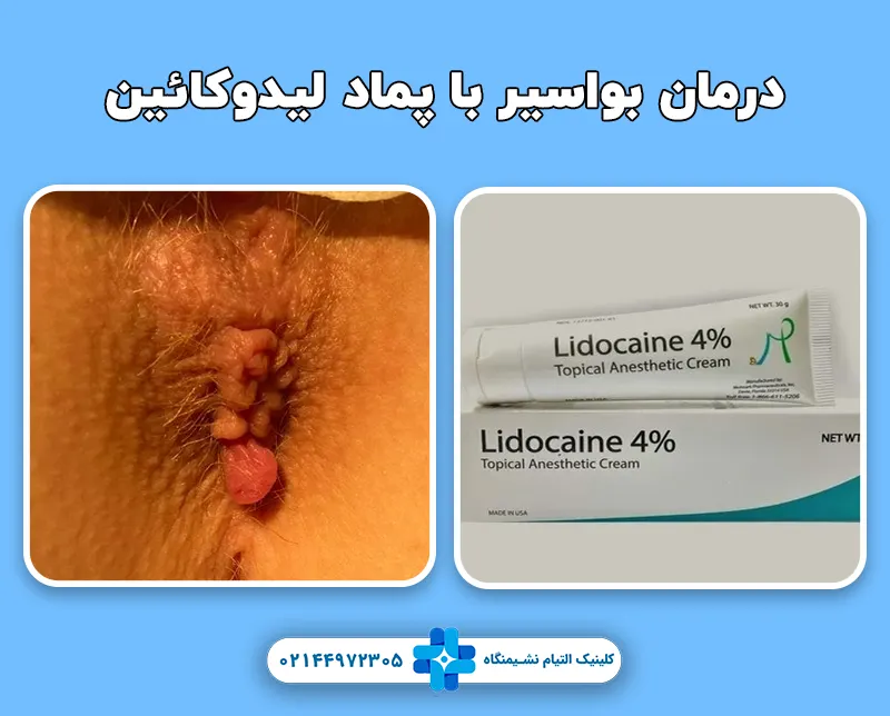 پماد لیدوکائین
