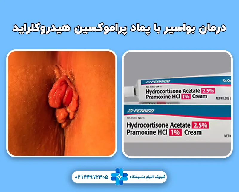 پماد پراموکسین هیدروکلراید