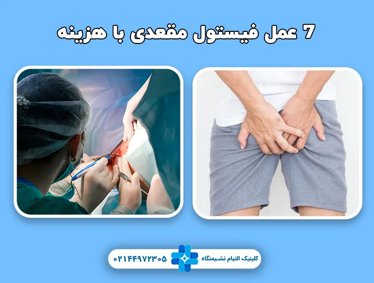 7 عمل فیستول مقعدی با هزینه