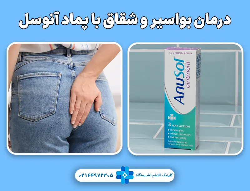 درمان بواسیر و شقاق با پماد آنوسل