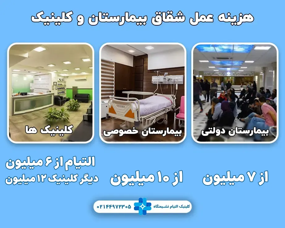 هزینه عمل شقاق