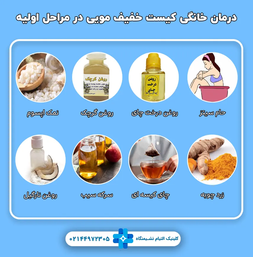 درمان های خانگی کیست مویی