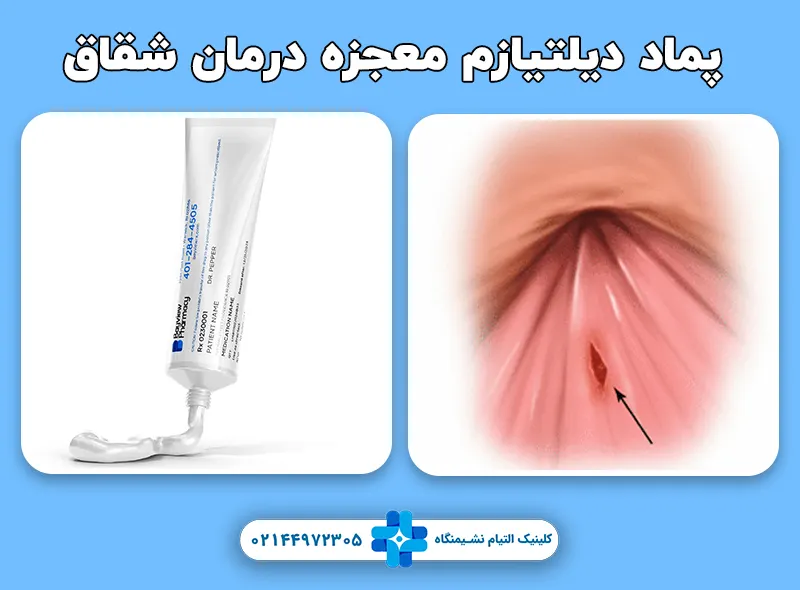 پماد دیلتیازم