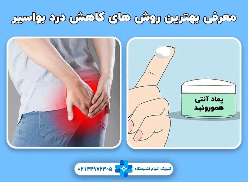 روش های کاهش درد بواسیر
