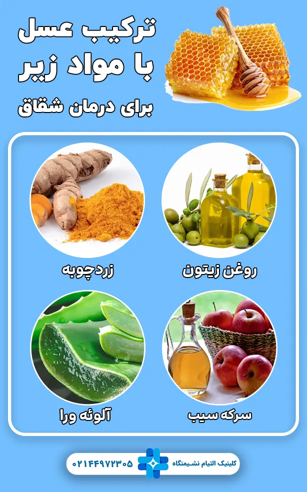 درمان جوش مقعدی با عسل