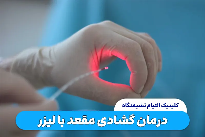 درمان گشاید مقعد با لیزر