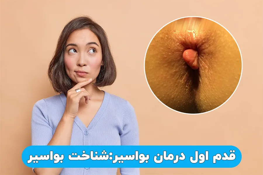 قدم اول درمان بواسیر شناخت بواسیر