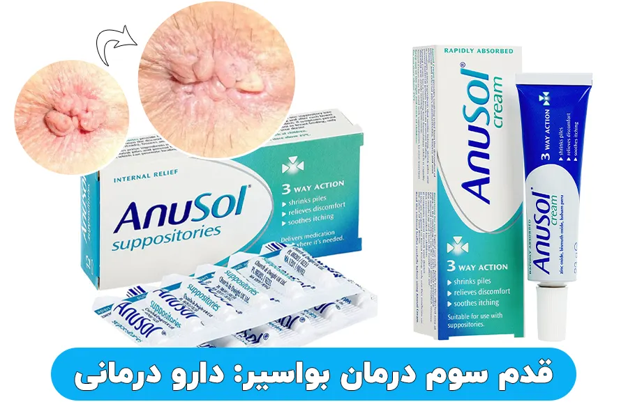 قدم سوم درمان بواسیر دارو درمانی