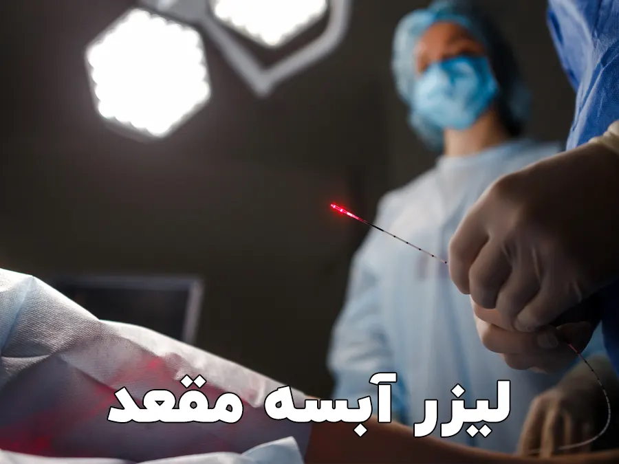 لیزر آبسه مقعد