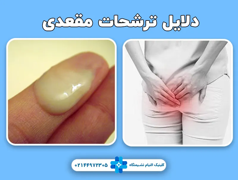 ترشحات مقعدی