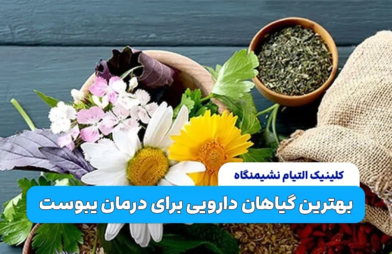 بهترین گیاهان دارویی برای درمان یبوست