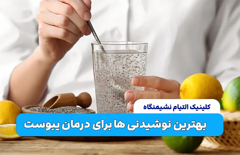 بهترین نوشیدنی ها برای درمان یبوست