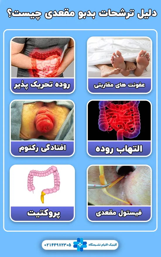 دلیل ترشحات بدبو مقعدی