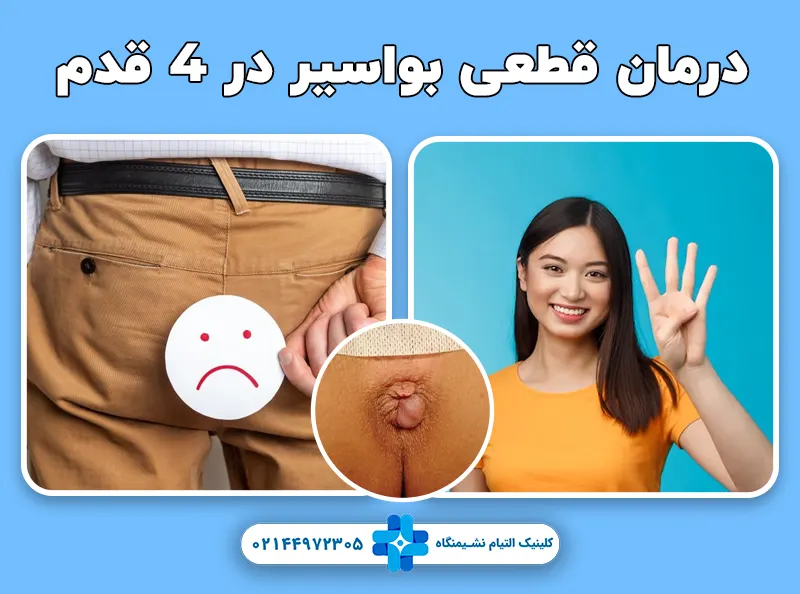 آموزش قدم به قدم در درمان بواسیر در 4 مرحله