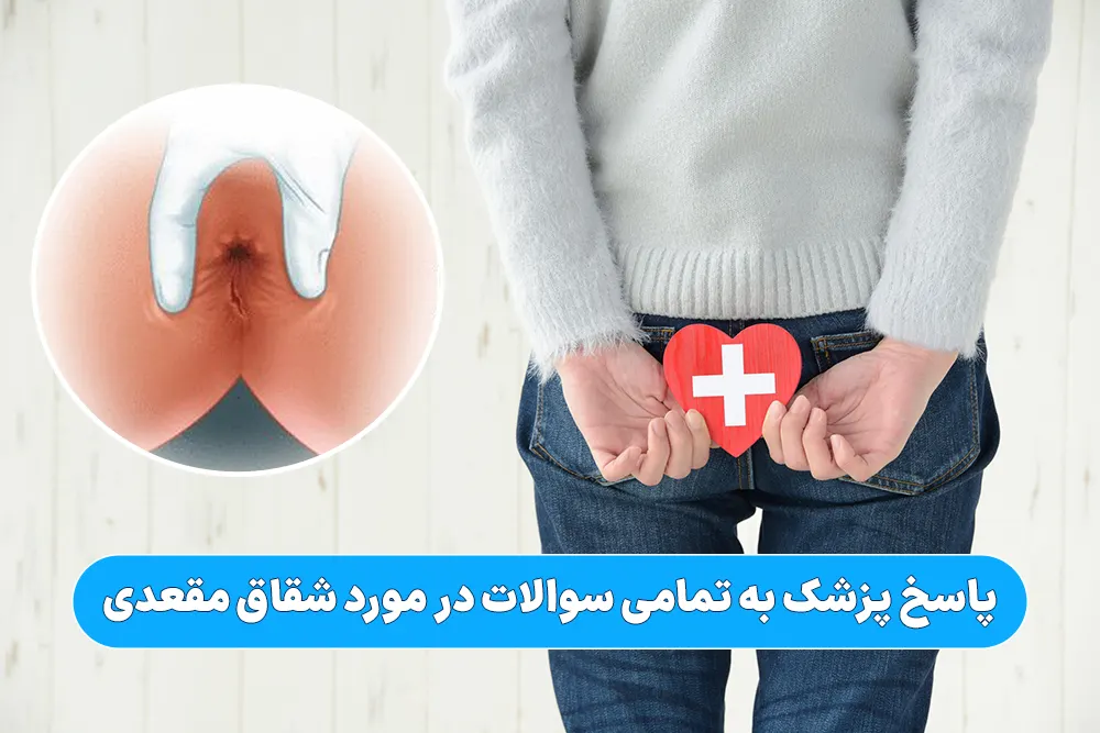پاسخ پزشک به تمامی سوالات در مورد شقاق مقعدی
