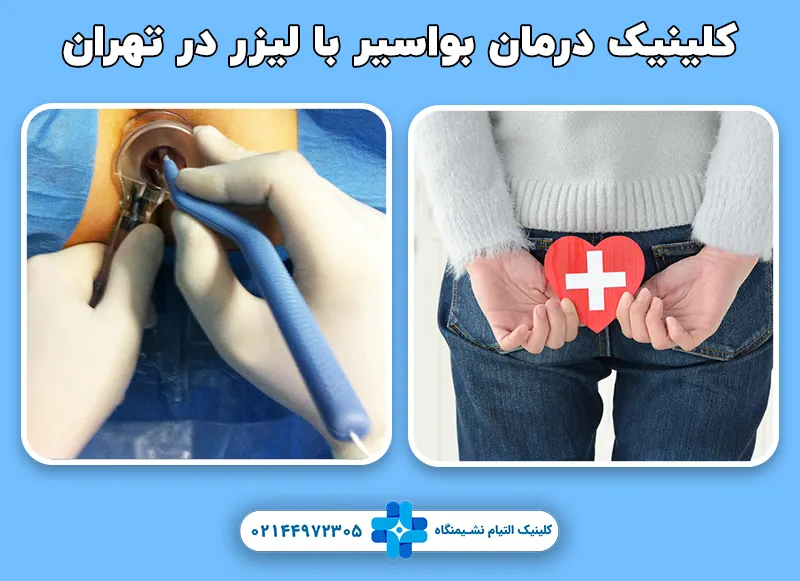 کلینیک درمان بواسیر با لیزر در تهران
