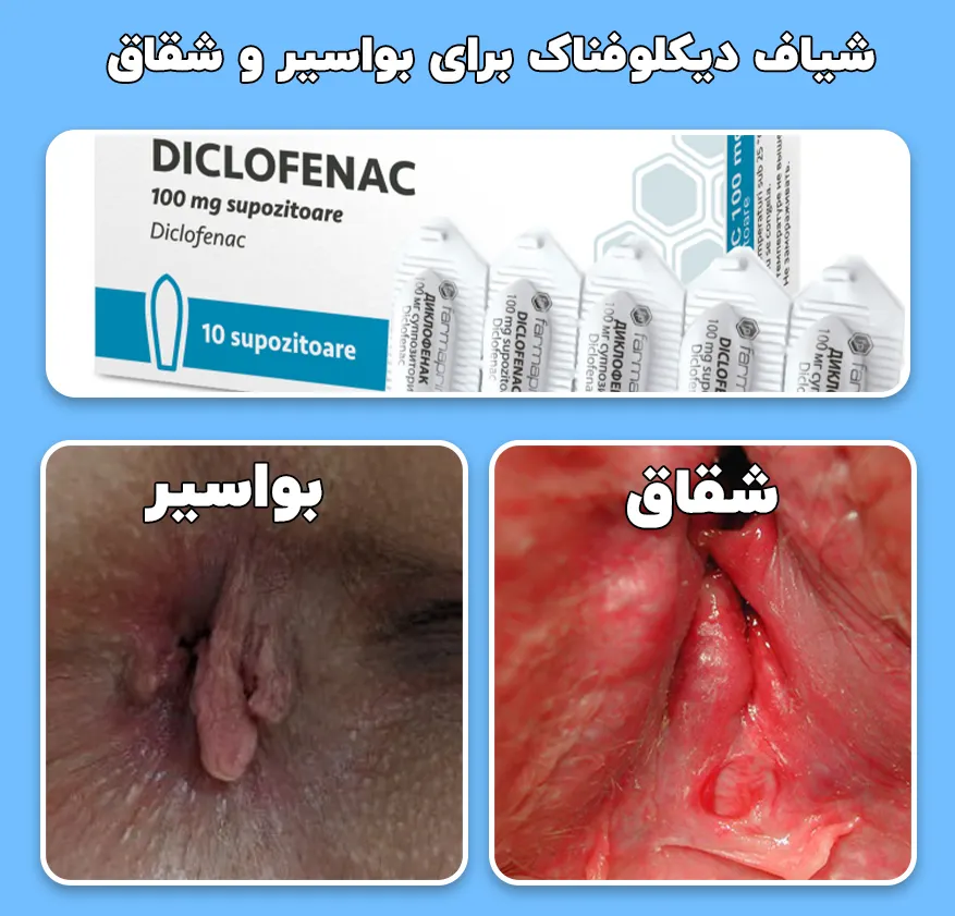 شیاف دیکلوفناک برای شقاق و بواسیر؟