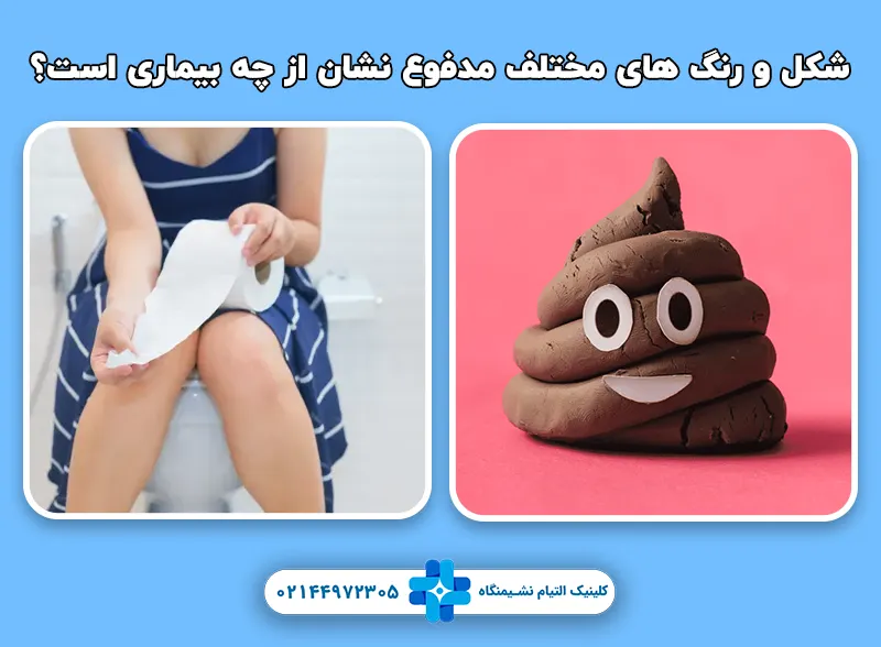 شکل و رنگ های مختلف مدفوع
