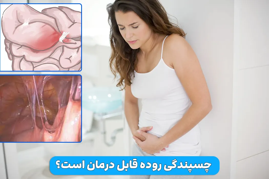 درمان چسبندگی روده