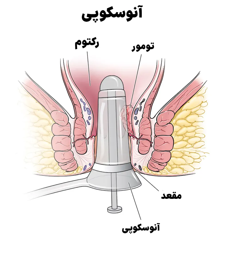 آنوسکوپی چیست؟