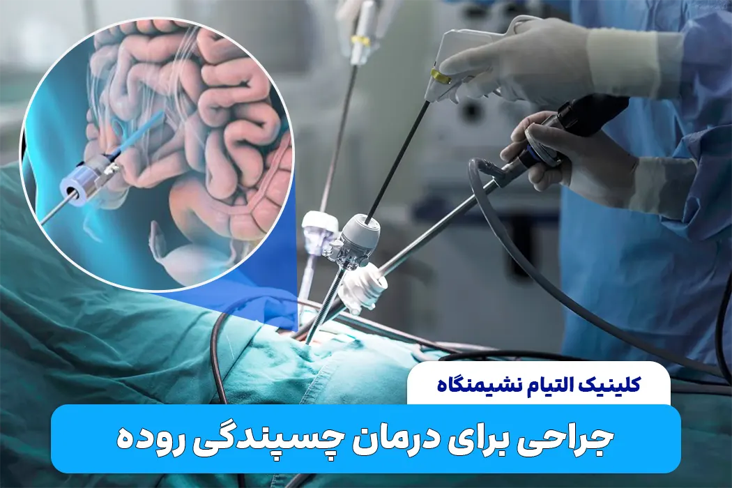 جراحی چسبندگی روده