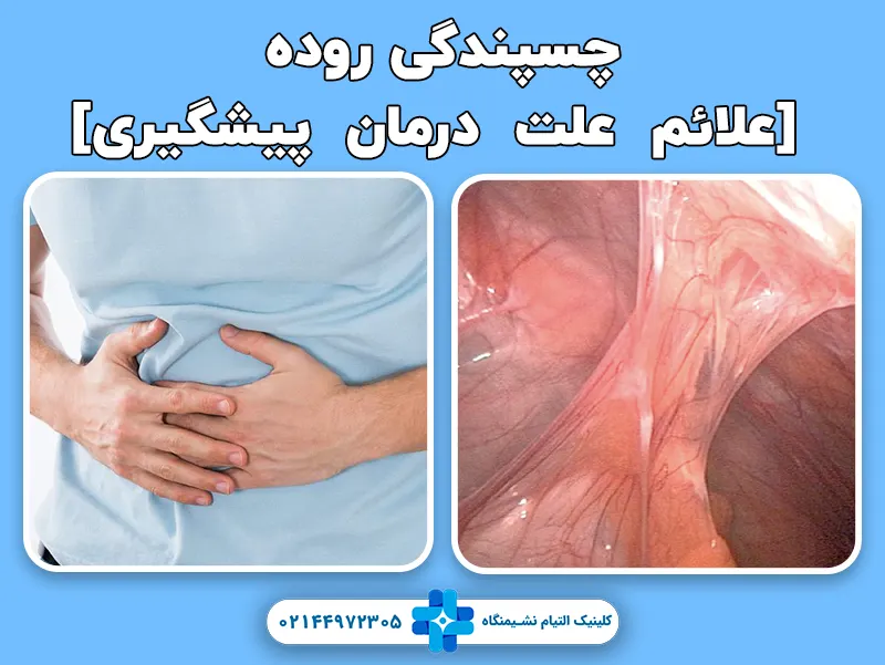 چسبندگی روده