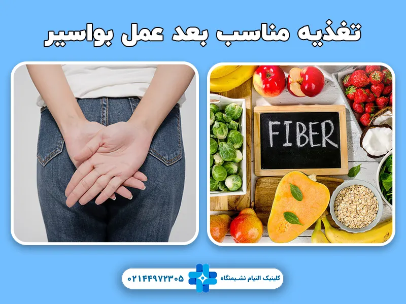 تغذیه مناسب بعد عمل بواسیر