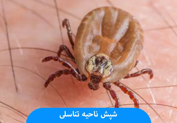 شپش ناحیه تناسلی (پدیكولوزیس پوبیس)