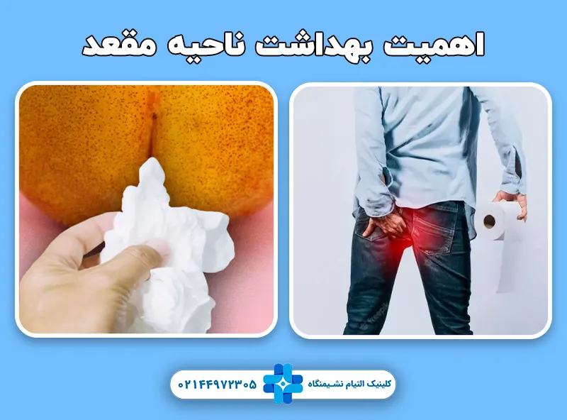 اهمیت بهداشت ناحیه مقعد