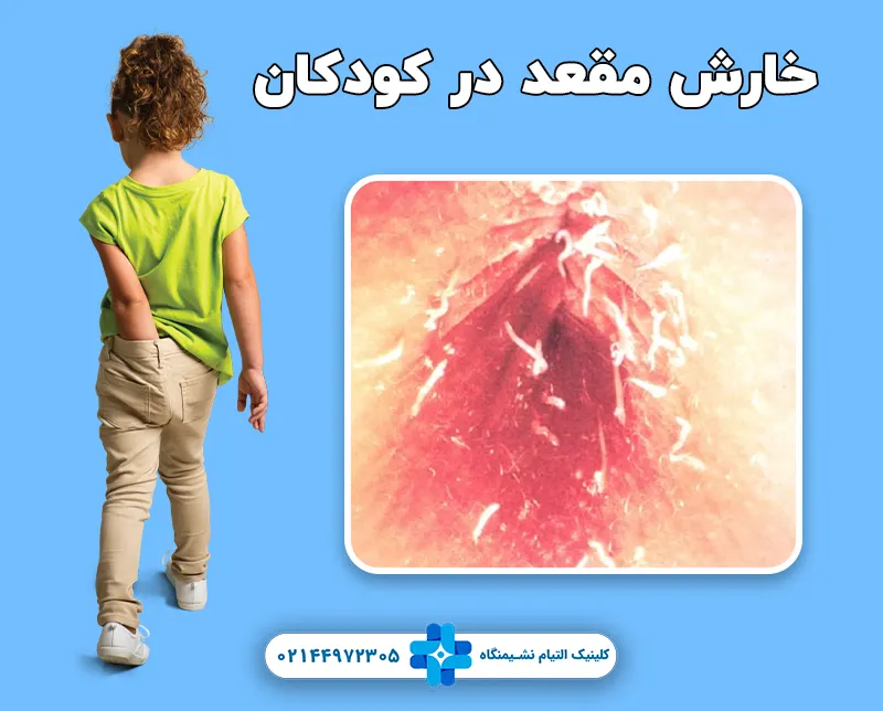 خارش مقعد در کودکان