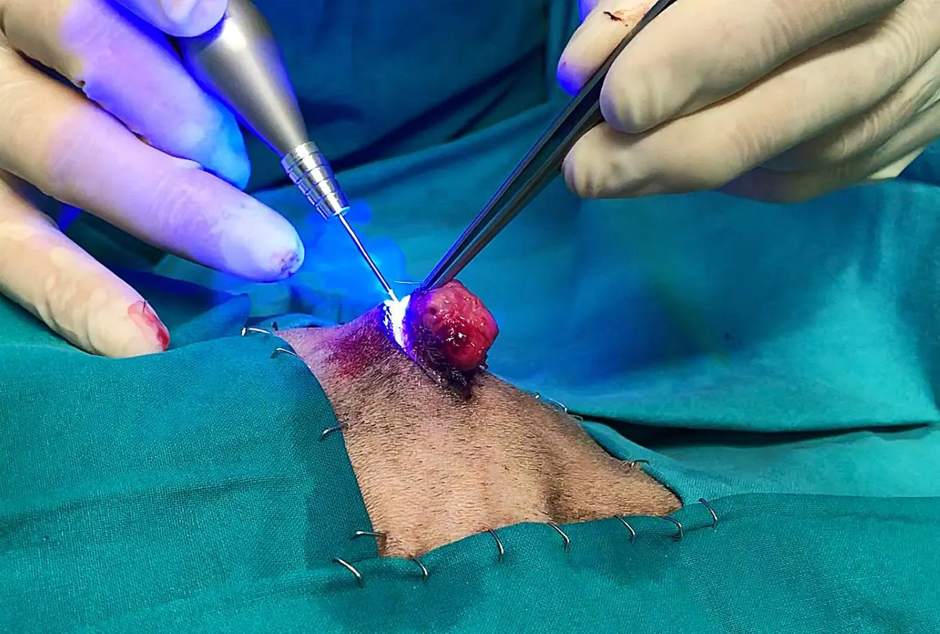 لیزر جراحی co2